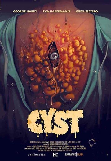 فيلم Cyst 2020 مترجم اون لاين